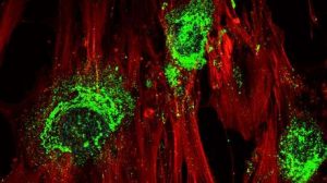 Células madre - Células madre