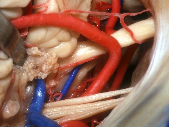 Explorando la anatomía del cerebro humano 10 -