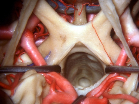 Explorando la anatomía del cerebro humano 3 -
