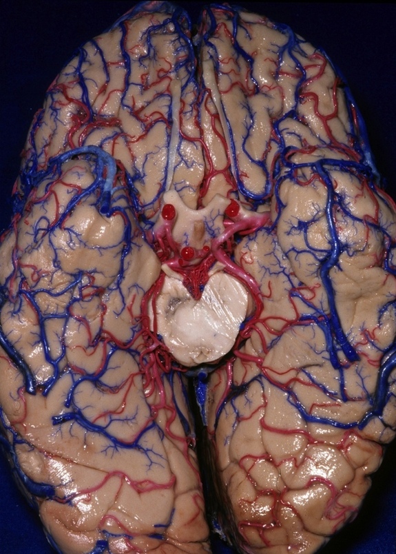 Explorando la anatomía del cerebro humano 5 -
