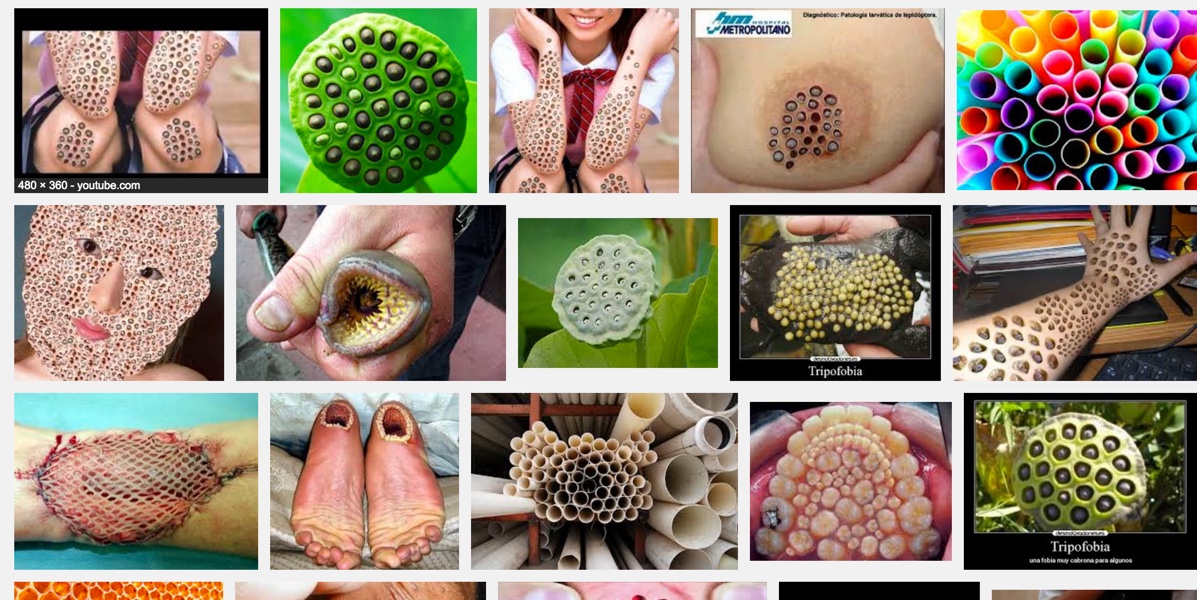 tripofobia - tripofobia