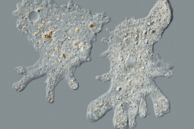 Las 10 enfermedades infecciosas más letales vistas bajo Microscopio 6 -