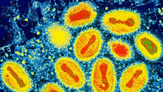 Las 10 enfermedades infecciosas más letales vistas bajo Microscopio 4 -