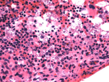 Las 10 enfermedades infecciosas más letales vistas bajo Microscopio 9 -