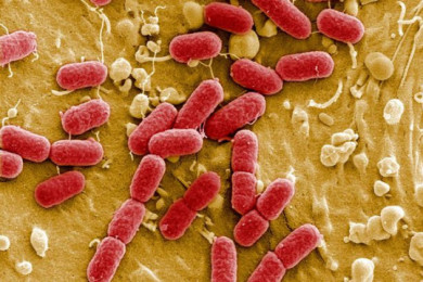 Las 10 enfermedades infecciosas más letales vistas bajo Microscopio 5 -
