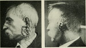 Efectos del Radio.
