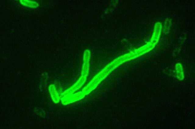 Yersinia Pestis 200x magnificada con colorante fluorescente
