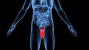 El primer bebé del mundo con 3 genitales masculinos, nació en Irak. 1 El primer bebé del mundo con 3 genitales. - El primer bebé del mundo con 3 genitales.