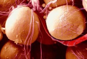 En la investigación el grupo de ratones - En la investigación el grupo de ratones