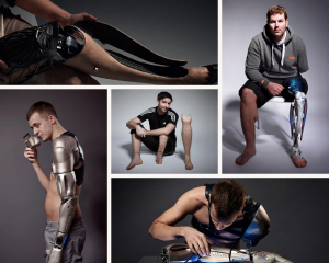 Prótesis funcionales donde se fusiona - Prótesis funcionales donde se fusiona