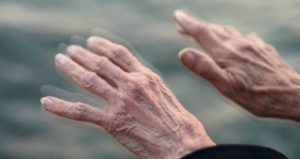 Parkinson - Parkinson