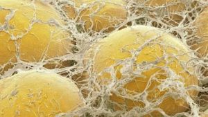 Mecanismo neuro-inmunológico participa en la pérdida de grasa. 1 Descubren mecanismo entre cerebro - Descubren mecanismo entre cerebro