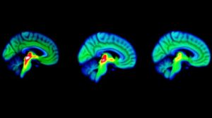 Oxitocina podría reducir - Oxitocina podría reducir