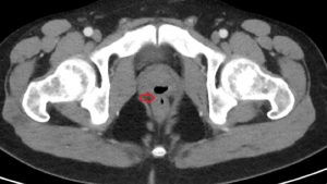Caso de paciente - Caso de paciente