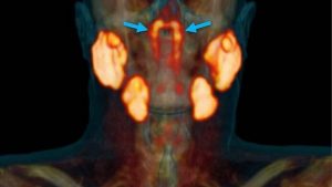 nuevos órganos - nuevos órganos
