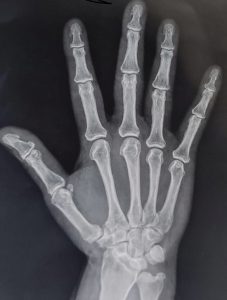 Nueva enfermedad descubierta - Nueva enfermedad descubierta