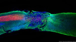 Científicos logran revertir parálisis - Científicos logran revertir parálisis