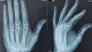 Nueva enfermedad descubierta - Nueva enfermedad descubierta