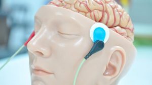 Ing. Espacial/neurocirujanos - Ing. Espacial/neurocirujanos