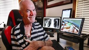 Hombre paralizado (ELA) publica tuit solo con pensamiento. 3 Hombre paralizado (ELA) publica - Hombre paralizado (ELA) publica