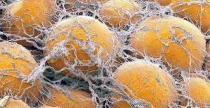 Encuentran nueva ruta de regularización del azúcar en sangre. 4 Encuentran nueva ruta de regularización - Encuentran nueva ruta de regularización