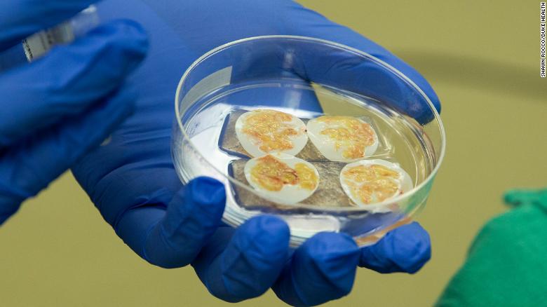 por primera vez a nivel mundial, un bebé recibe trasplante de corazón y timo del mismo donante 4 -