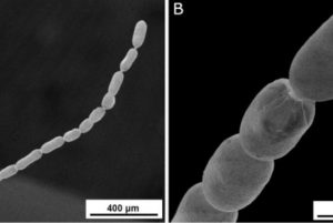 Descubren bacteria de 1 cm, observable a simple vista. 5 Bacteria - Bacteria