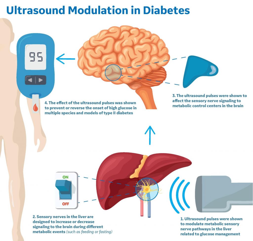 Nueva forma de tratar la diabetes sin necesidad de insulina es descubierta según los científicos 1 -