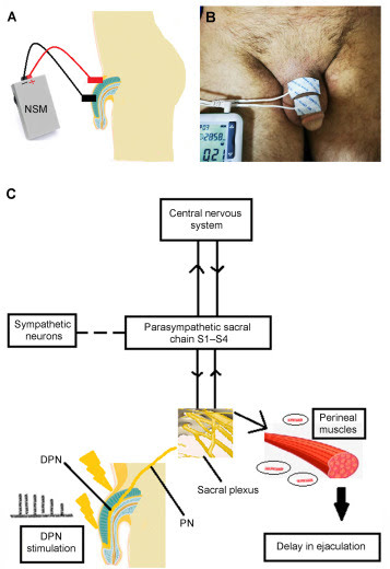 Equipo de investigación de Líbano encuentra un tratamiento eficaz contra la eyaculación precoz. 2 -