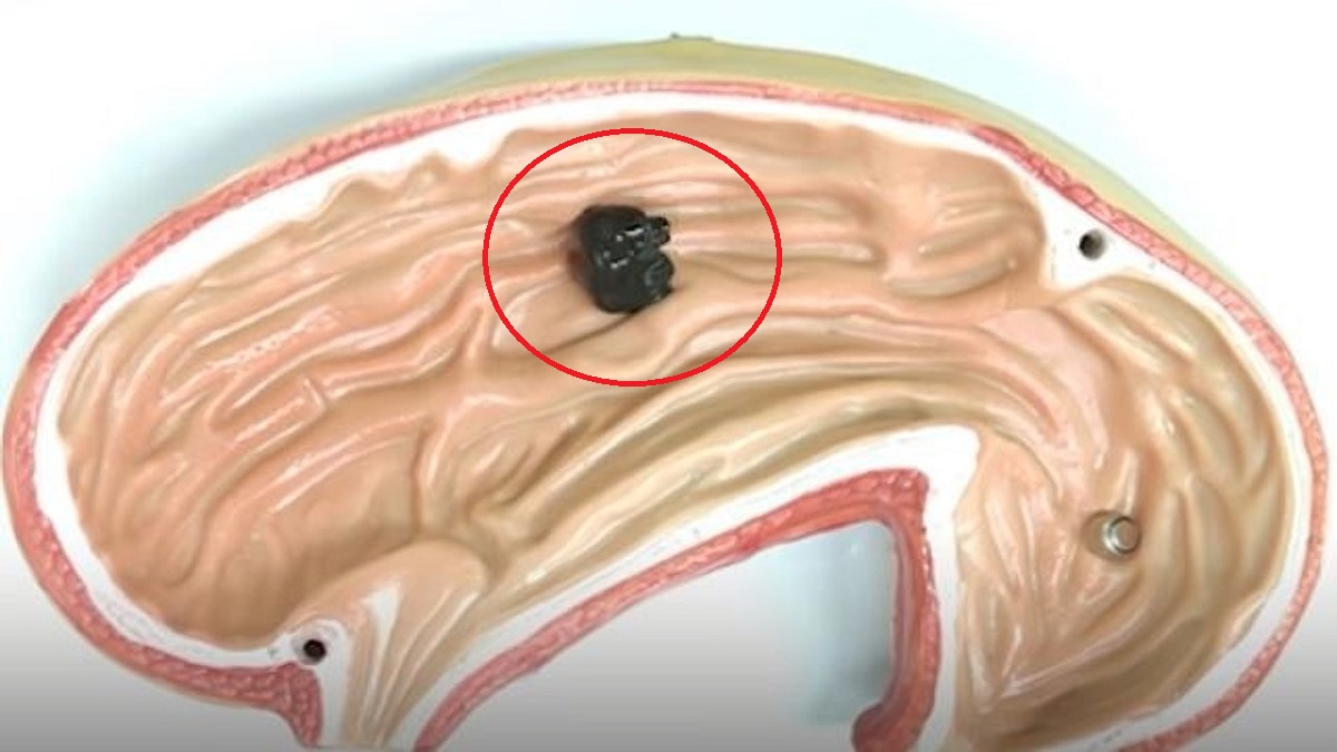 Robot hecho de limo magnético que puede ser controlado de forma remota a través de un campo magnético, dentro de un cerebro simulado.