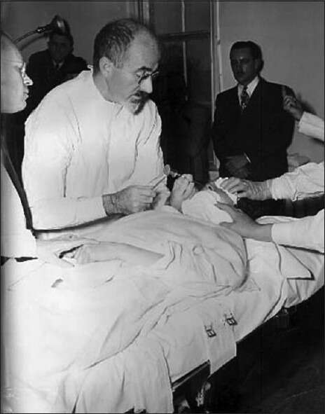 lobotomías - lobotomías