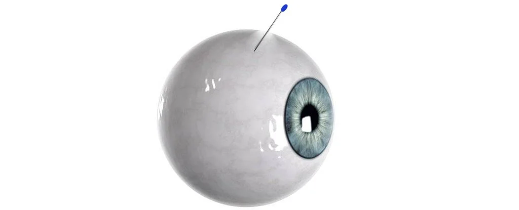 Científicos crearon una microaguja para el ojo que se "autoconecta" y es tan espeluznante como parece 1 aguja - aguja