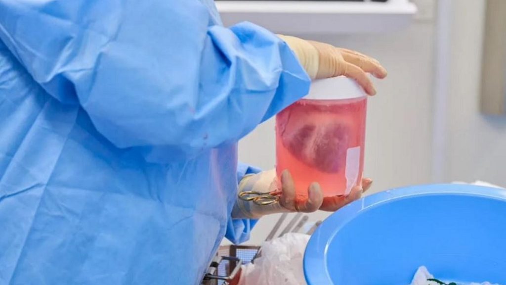 Trasplanta con éxito dos corazones de cerdo editados genéticamente a personas con muerte cerebral 1 -