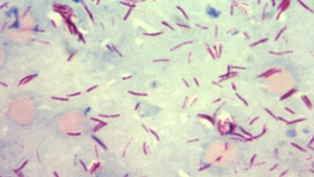 Uno de los peores parásitos del mundo podría ocultar un sorprendente efecto curativo 1 -