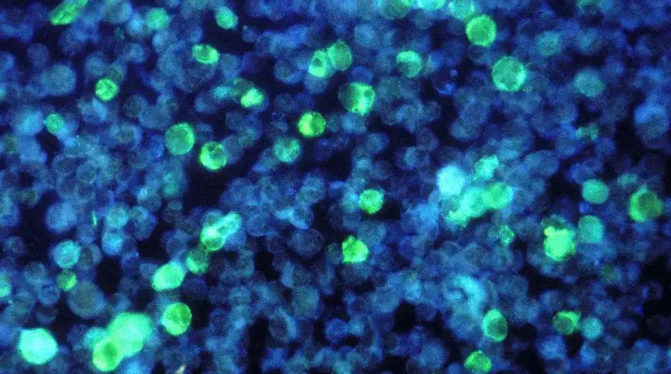 Los mayores avances médicos de 2022 4 -