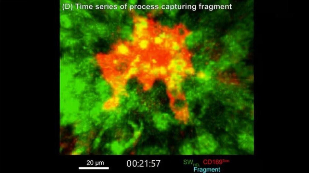 Por primera vez, los científicos obtienen imágenes de una misteriosa célula inmunitaria en tiempo real 1 -