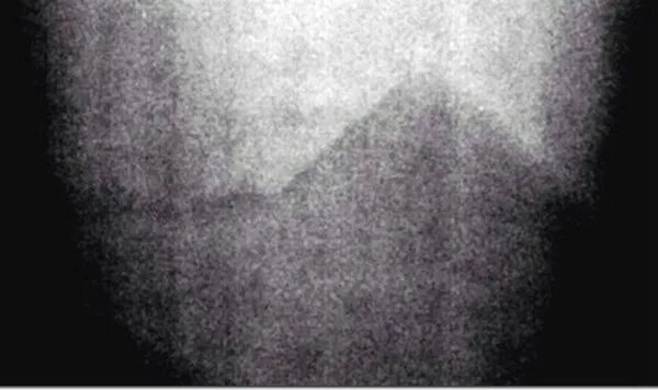 Fotos espeluznantes que siguen sin explicación 10 Fotos espeluznantes que siguen sin explicación