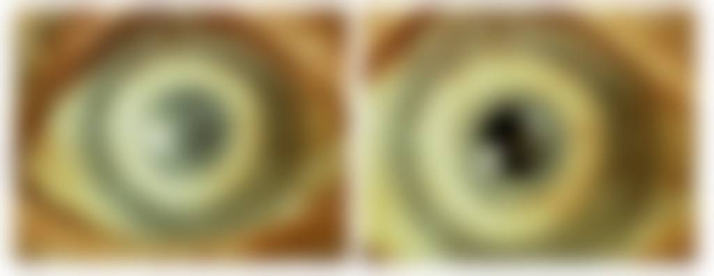 queratoprótesis - queratoprótesis