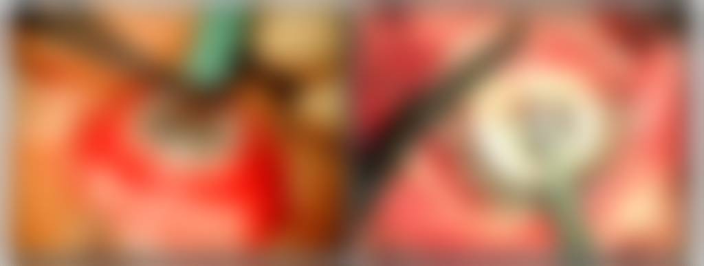 queratoprótesis - queratoprótesis