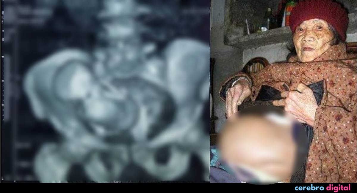 El curioso caso del bebé de piedra 1 -