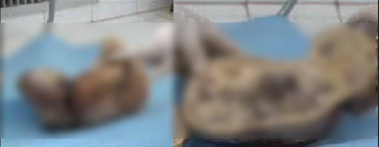 El curioso caso del bebé de piedra 3 -