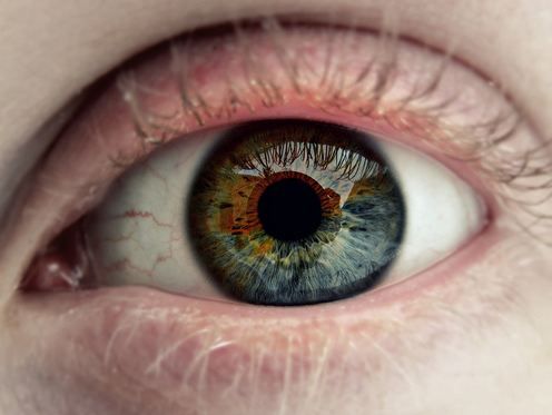 ¿Qué es la heterocromía? 3 heterocromía - heterocromía