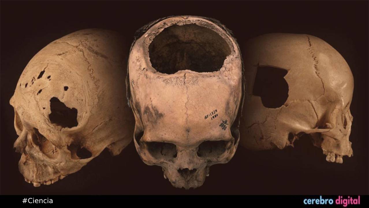 Operación de cráneos en la antigüedad ¿Por qué los Incas eran especialistas en esta práctica?