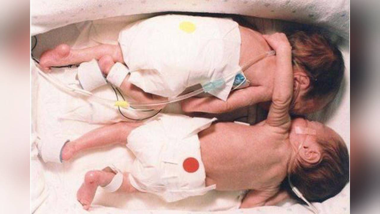 El Abrazo del Rescate: La imagen que cambió la historia de la medicina