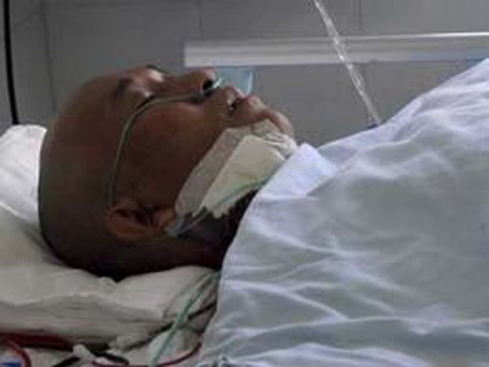 Li Fuyan: el hombre que vivió cuatro años con un cuchillo en la cabeza