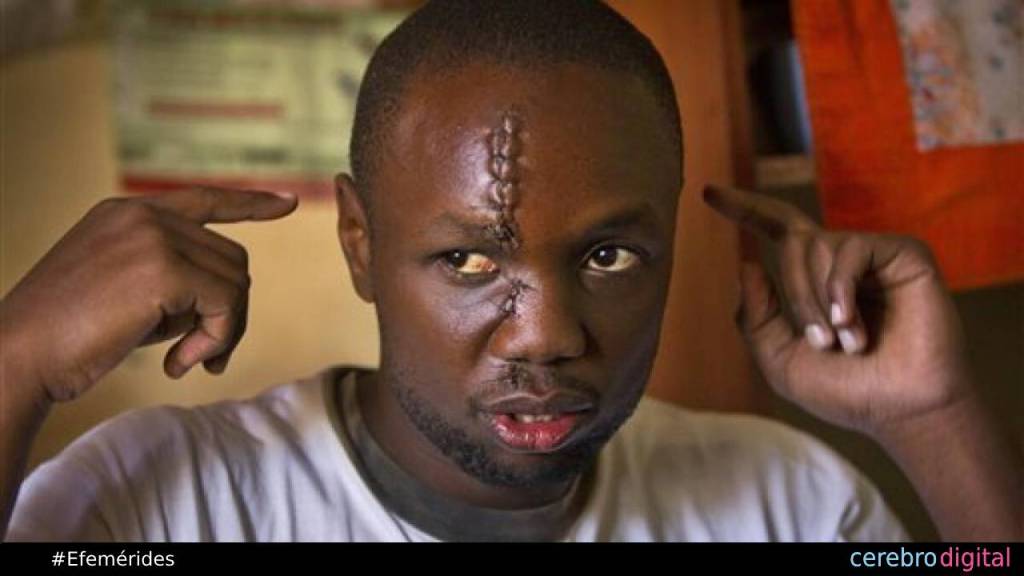 Anthony Omari: el superhéroe de la cicatriz