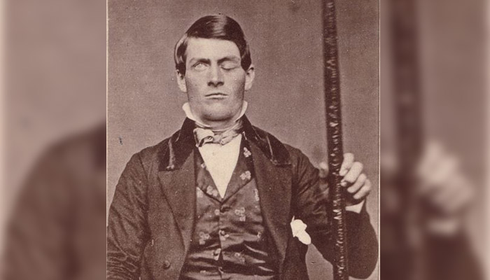 https://staging-7b2a-cerebrodigitalnet.wpcomstaging.com/wp-content/uploads/2023/10/phineas-gage-how-did-he-survive-a-steel-rod-that-pierced-and-destroyed-his-frontal-lobe-cover-1.jpg