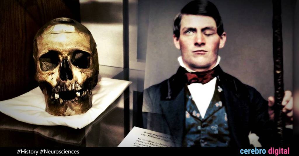 Phineas Gage: How did he survive a steel rod that pierced and destroyed his frontal lobe?