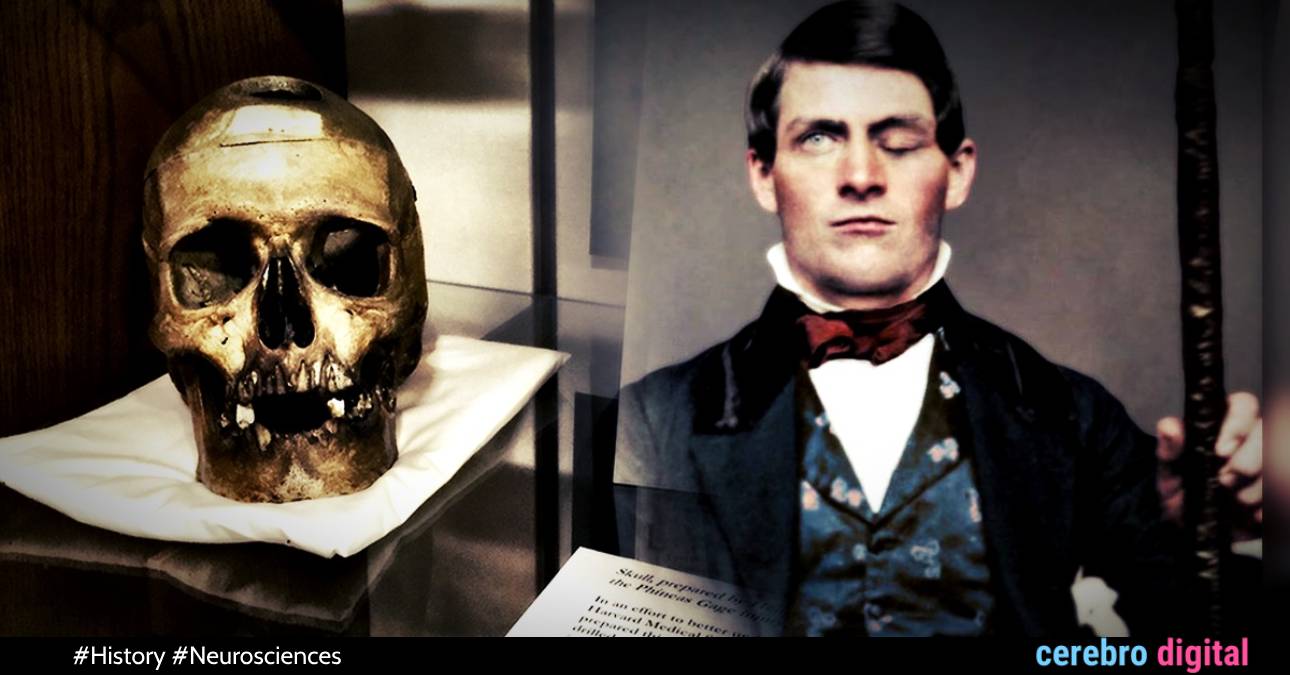 Phineas Gage: How did he survive a steel rod that pierced and destroyed his frontal lobe?