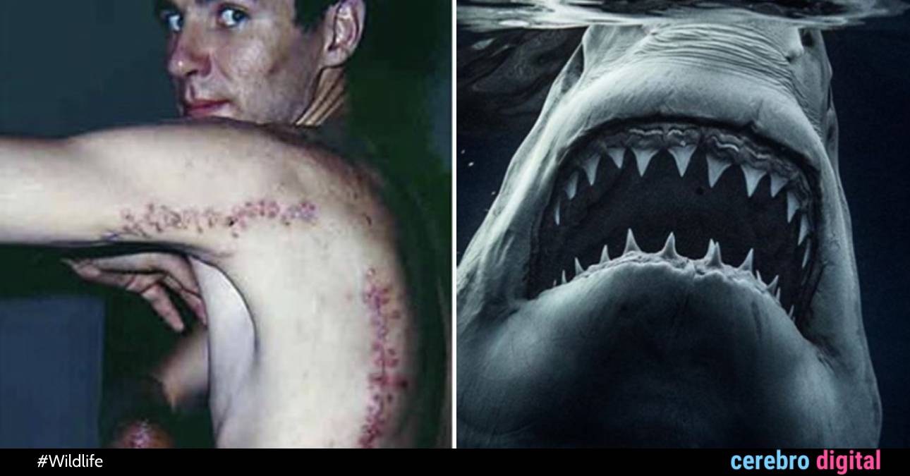 Rodney Fox: The Man Who Survived a Great White Shark Attack